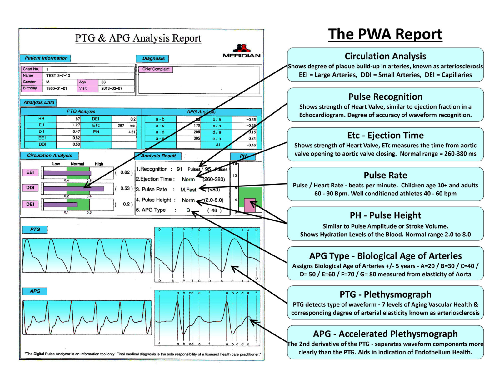 1-PWA Report - Summary