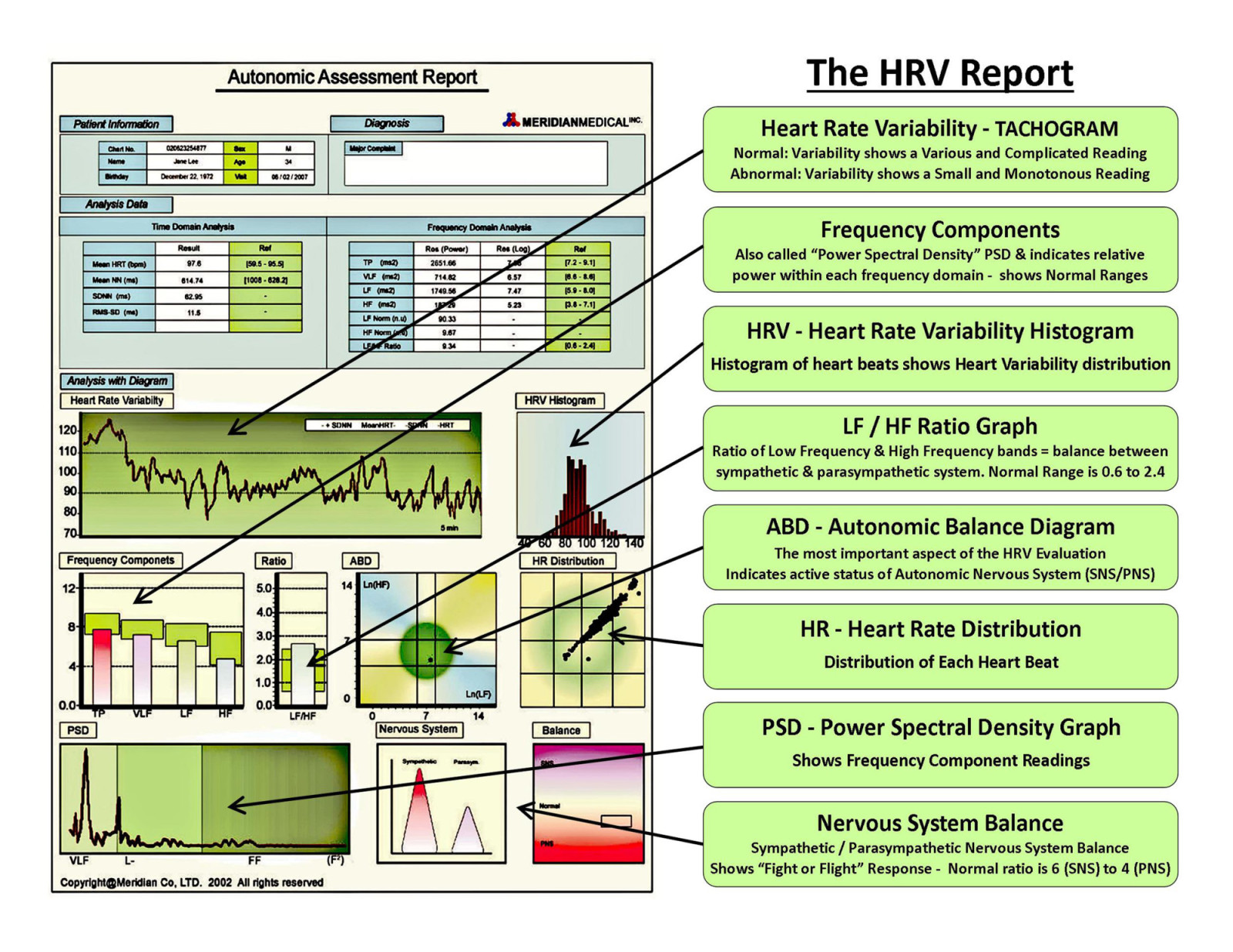 2-HRV Report - Summary